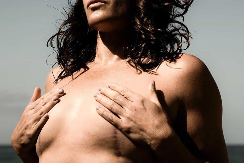 Zigano suffered with Breast Implant Illness (Instagram: Cat Zigano)