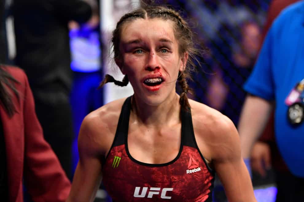 Jedrzejczyk's face ballooned up during her fight with Zhang Weili at UFC 248 (Twitter: @thaydrian)