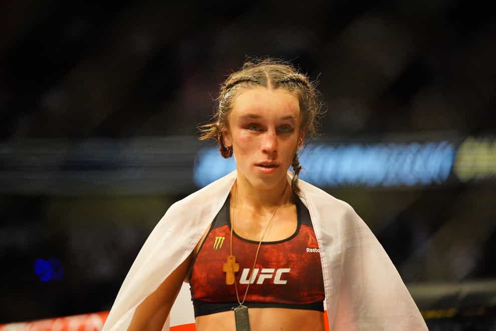 Joanna Jedrzejczyk shows off her discoloured face seven days after UFC bout (PA Images)