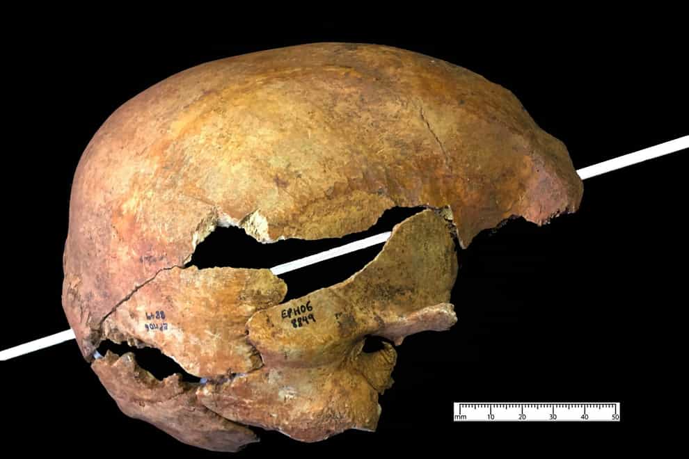 A skull with a piercing arrow