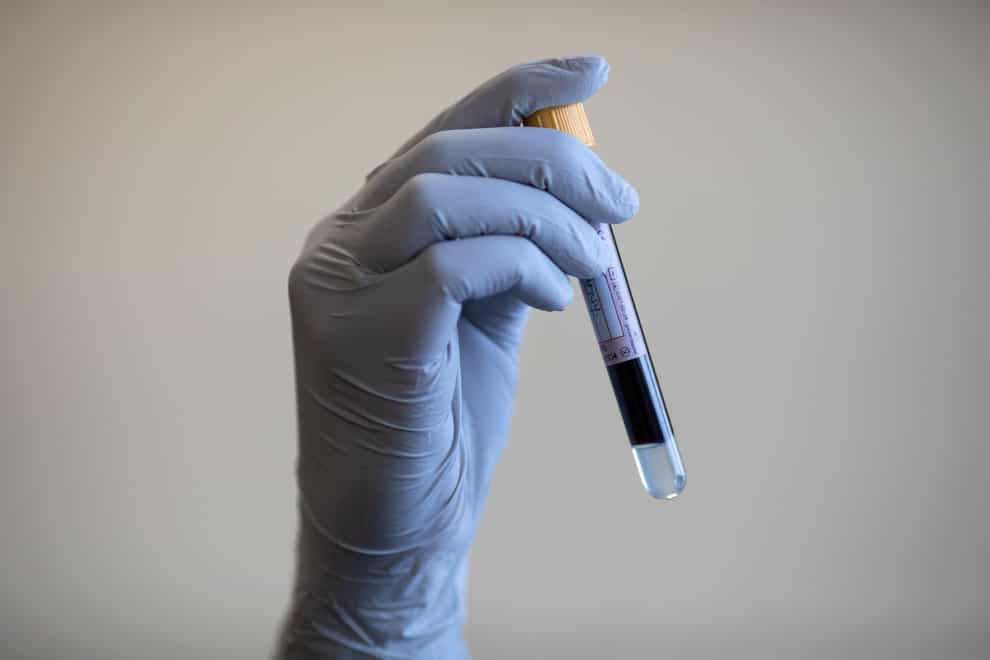 A paramedic holds a test tube containing a blood sample