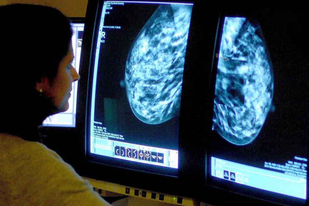 A consultant examining a mammogram