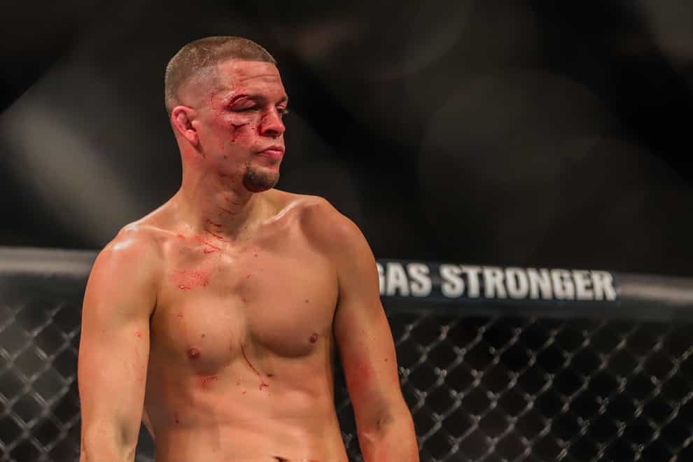 No one knows when Diaz will choose to return to the octagon