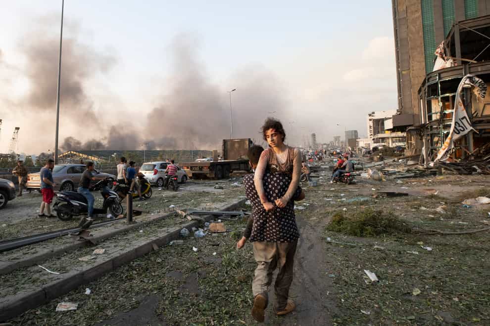 A wounded woman being carried from the blast site