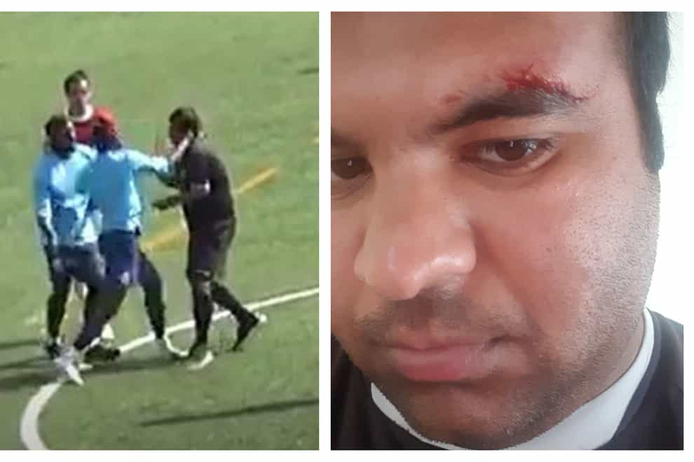 Satyam Toki was punched three times by the non-league player 