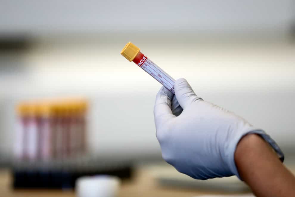 A paramedic holds a test tube containing a blood sample