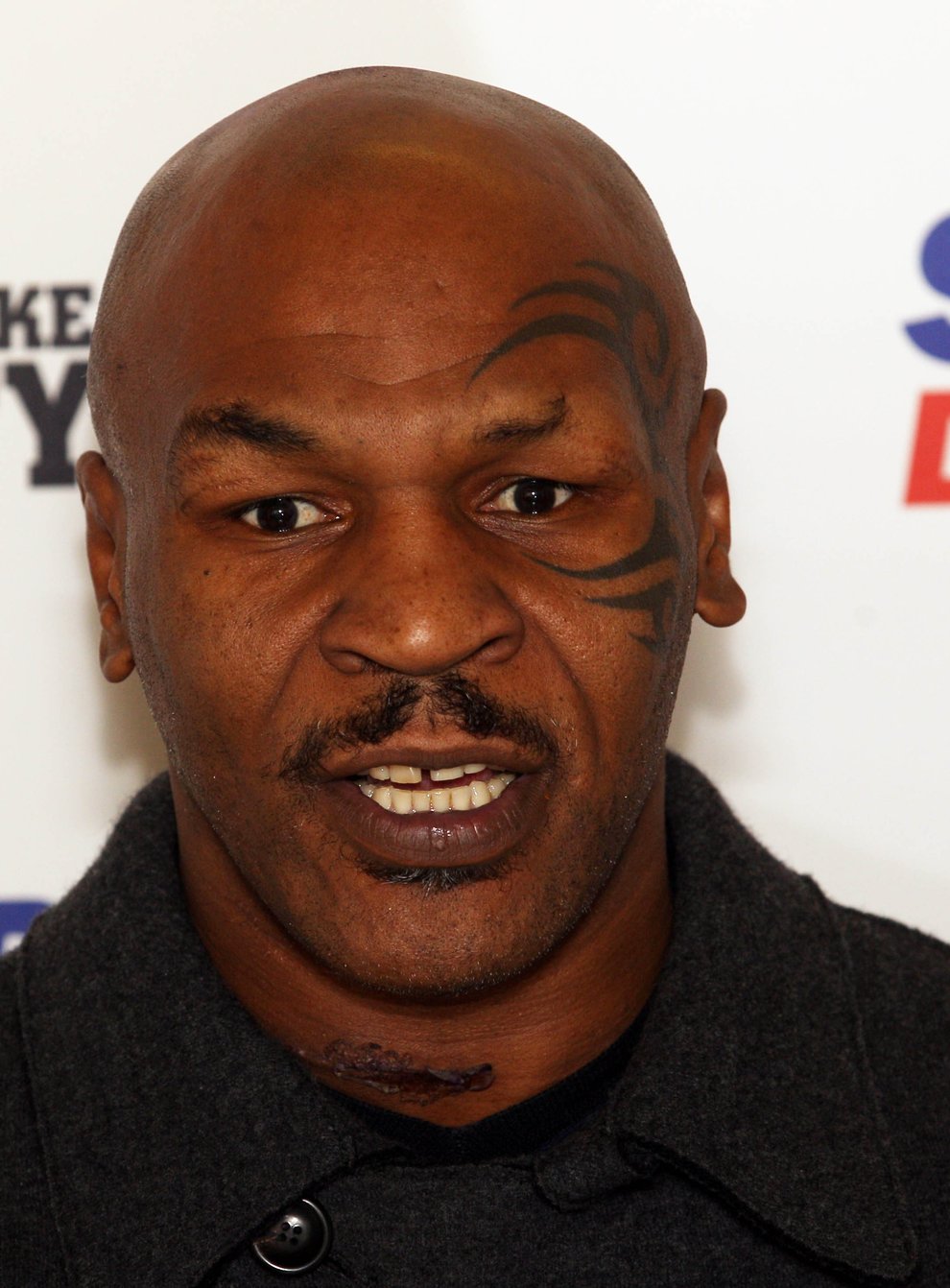 Tyson slurred his words throughout the interview with ITV on Tuesday