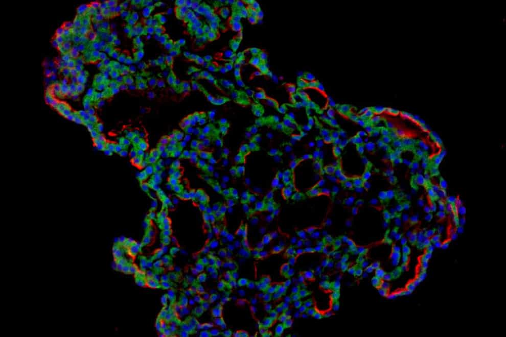 Representative image of three - dimensional human lung alveolar organoid