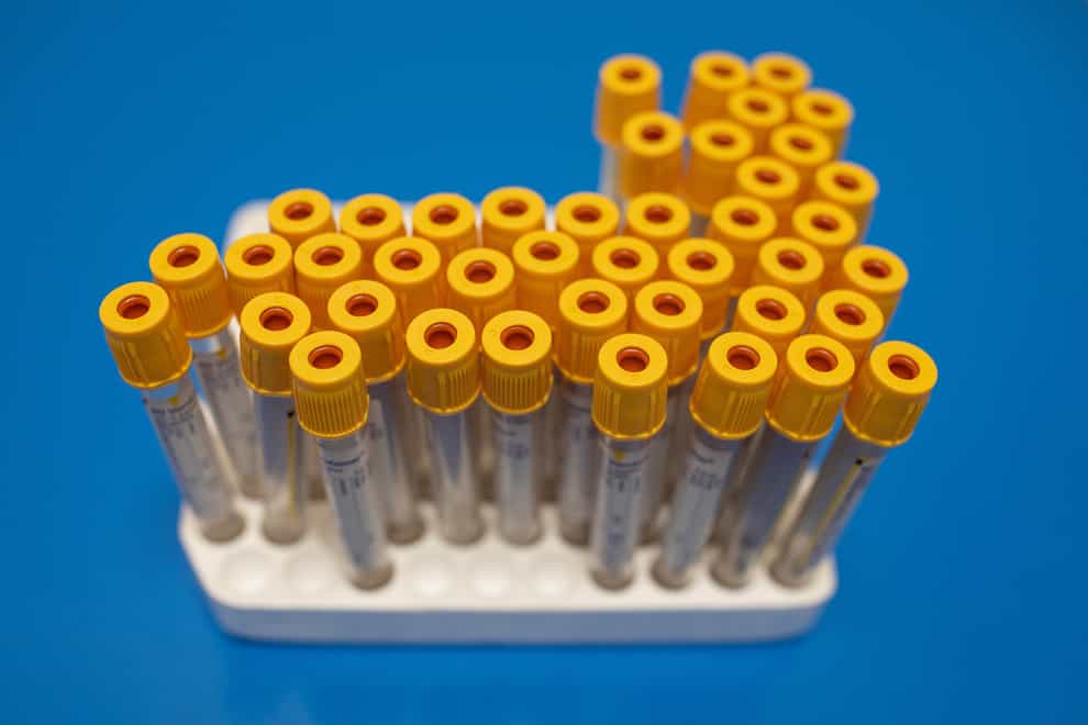 Test tubes to be used for blood samples sit on a table at a coronavirus antibody testing program
