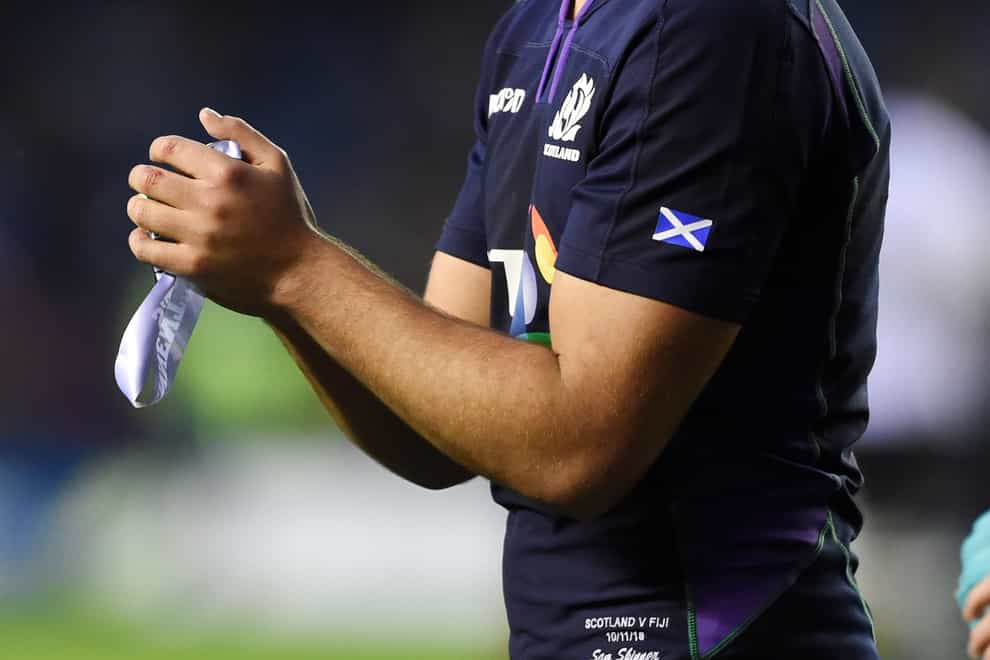 Sam Skinner reckons he is not the only member of the Scotland squad who has grown with confidence in recent months