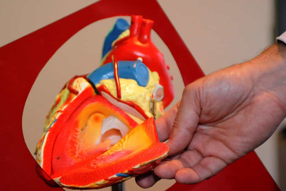 A demonstration model of a heart