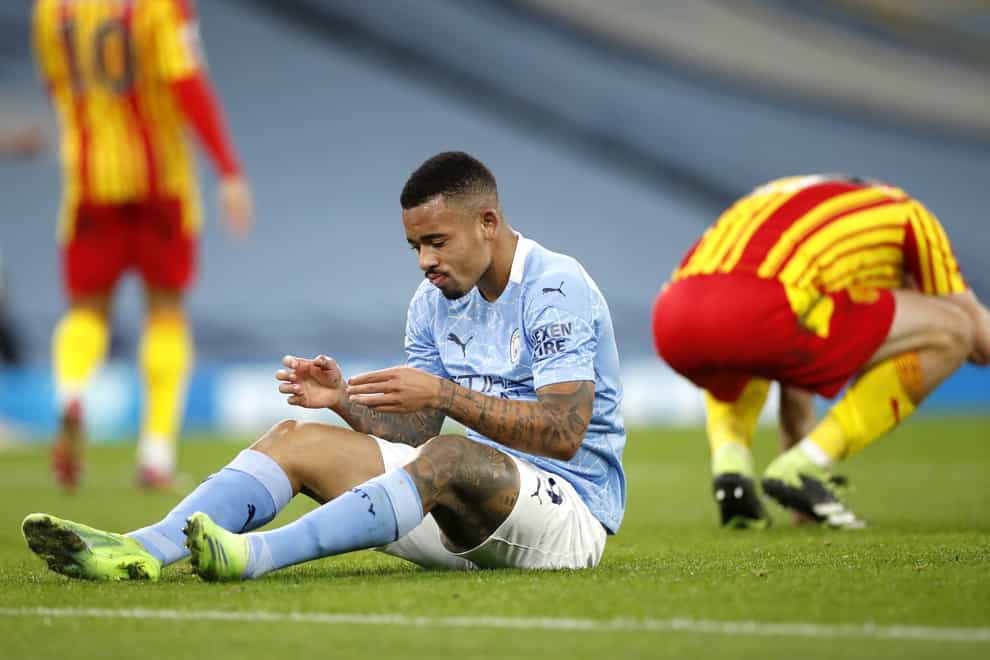 Manchester City have struggled in front of goal