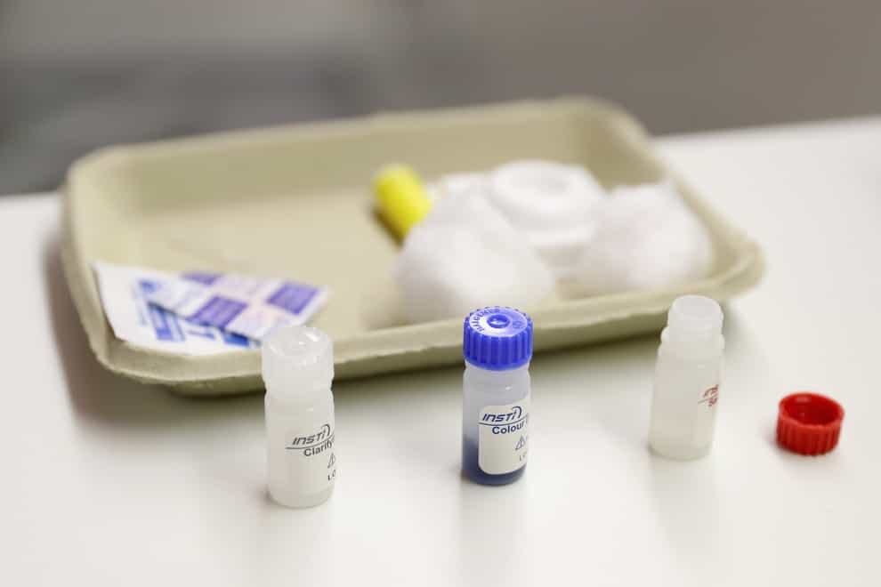 Standard HIV test