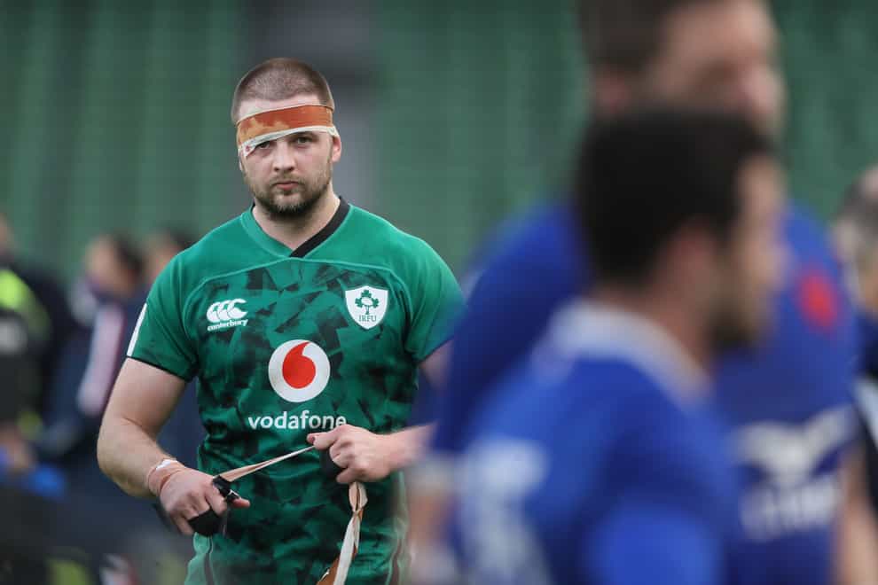 Stand-in Ireland skipper Iain Henderson was left bloodied following the defeat to France