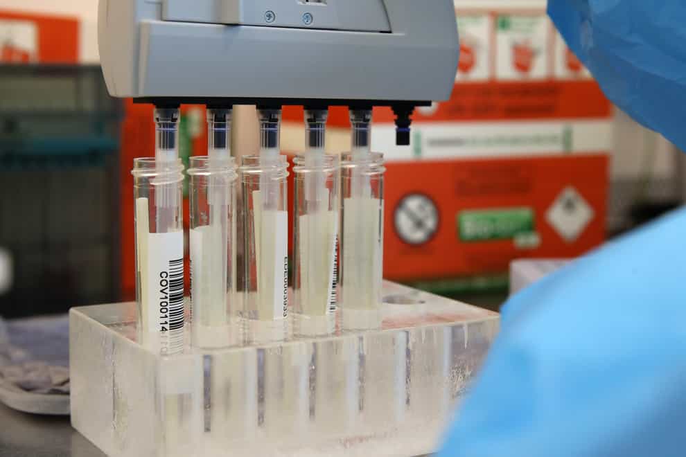 Coronavirus swabs in a laboratory