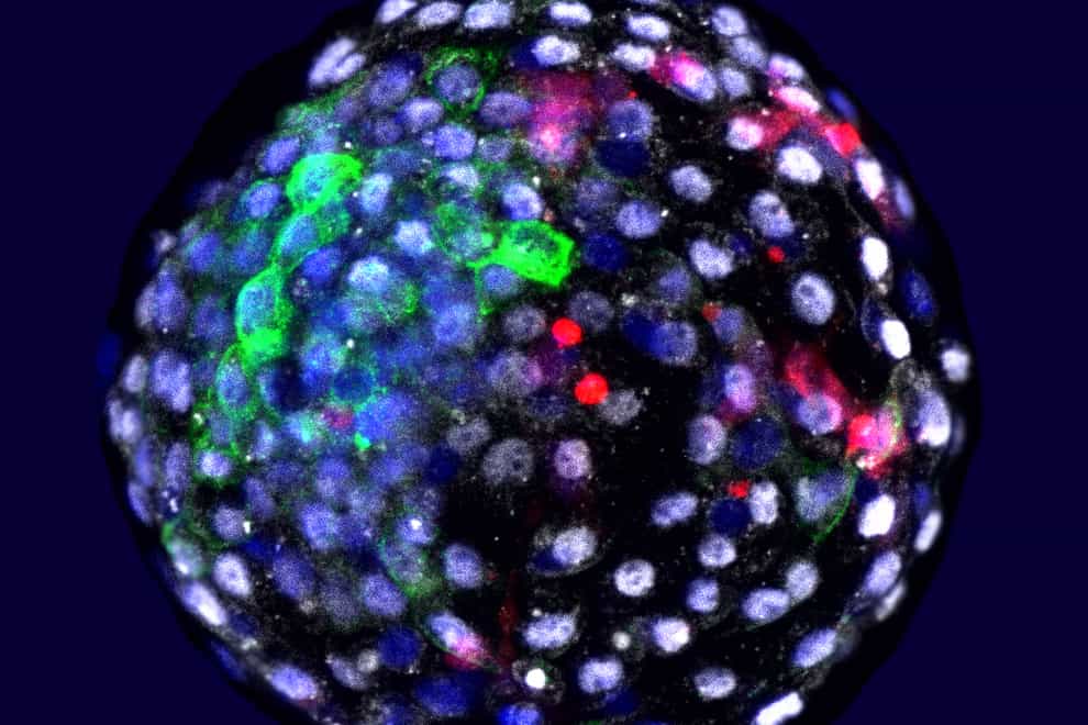 Human cells grown in early stage monkey embryo