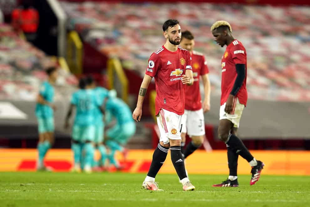 Bruno Fernandes cut a frustrated figure after Manchester United lost to Liverpool