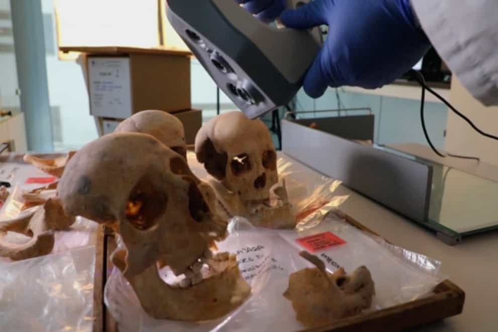 A scientist controls a 3D scanner over the alleged remains of bones of Christopher Columbus and family members, in the Anthropology Laboratory at Granada University in Spain