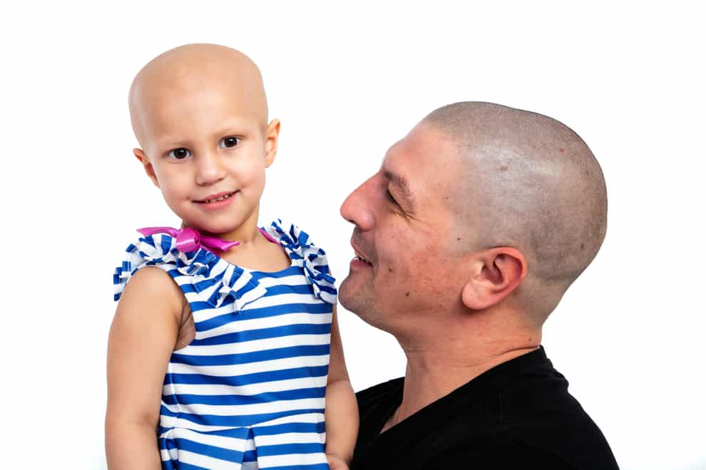 Aaron Lambert, 36, with his daughter Esme Lambert. Mr Lambert got a tattoo of his daughter's brain surgery scar so she does not feel like the 'odd one out'. (Wendy Lambert/ PA)