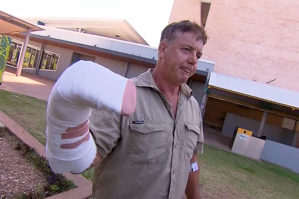 Sean Dearly shows off his bandaged arm after the crocodile attack (Channel 9 via AP)