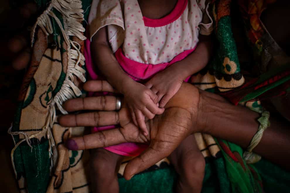 Abeba Gebru, 37, from the village of Getskimilesley, holds the hands of her malnourished daughter, Tigsti Mahderekal, 20 days old (Ben Curtis/PA)