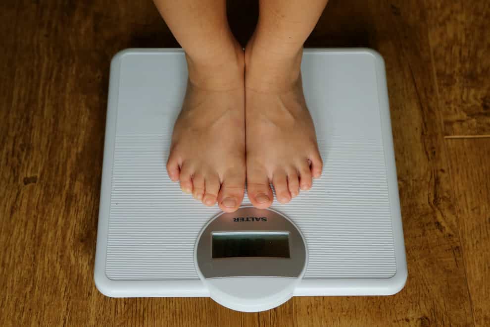 The rise in childhood obesity has been branded alarming (PA)