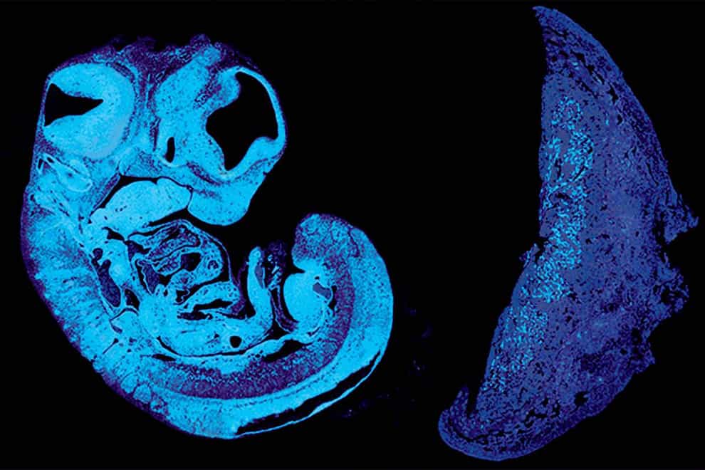 Cambridge scientists have identified a key signal that the baby uses to control its supply of nutrients from the placenta (Ionel Sandovici/PA)