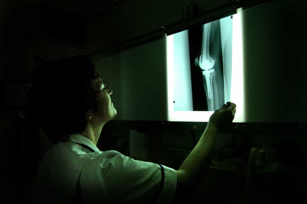 A medical expert examines an X-ray at the Royal Orthopaedic Hospital, Oswestry (David Jones/PA)