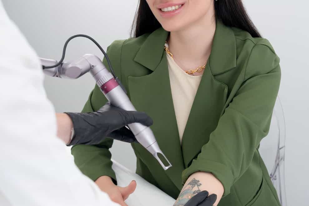 Want to know more about tattoo removal? (Alamy/PA)