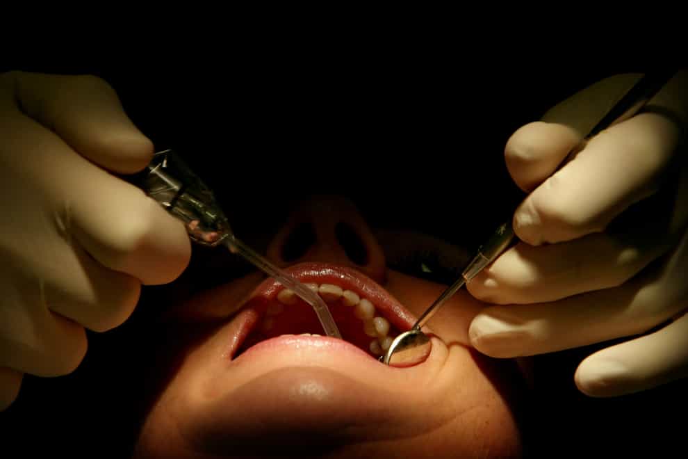 A £50 million catch-up fund has been announced for dentists in England (Anthony Devlin/PA)