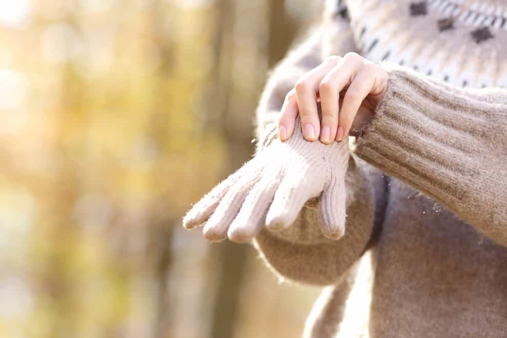 Could you have Raynaud’s? (Alamy/PA)