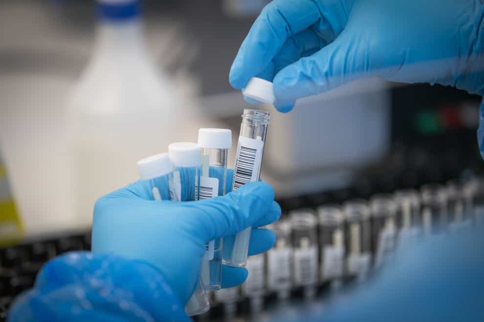 Patient samples are prepared for testing by scientists at the Glasgow Lighthouse Covid-19 testing facility (Jane Barlow/PA)