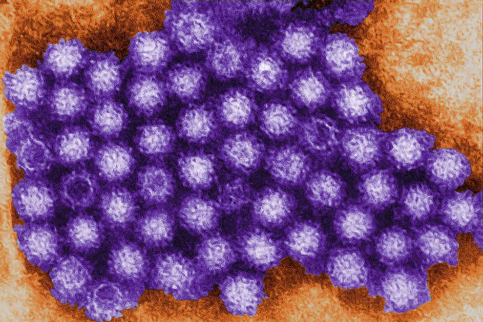 Norovirus (Charles D. Humphrey/Centres for Disease Control and Prevention/PA)