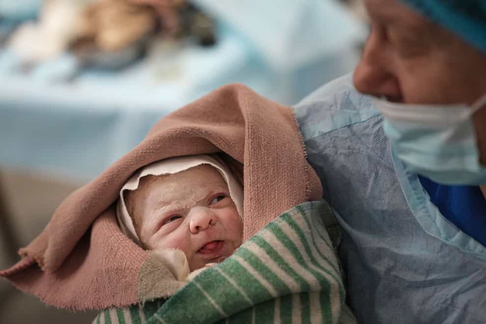A medical worker holds a newborn girl, Alana, who was born by cesarian section in a hospital in Mariupol, Ukraine. Ukrainian President Volodymyr Zelensky warned against the formation of ‘pseudo-republics’ in the south of his country as he revealed at least 1,300 Ukrainian troops have died so far in the invasion (Evgeniy Maloletka/AP)