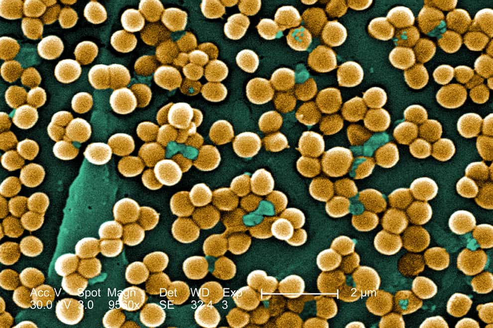 A photograph of the MRSA bacteria (PA)