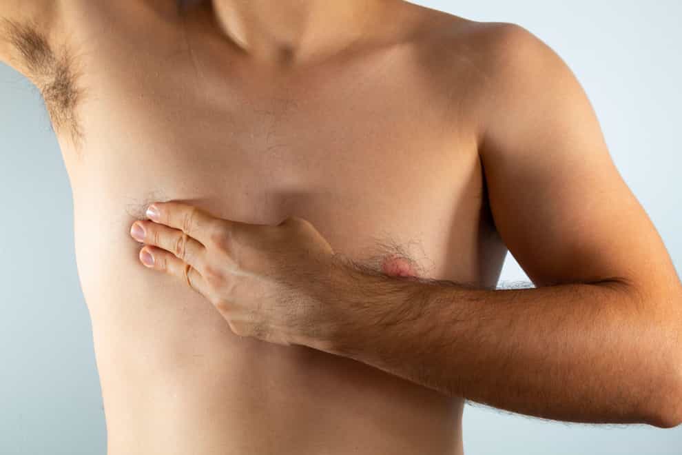 Always check your chest for changes (Alamy/PA)