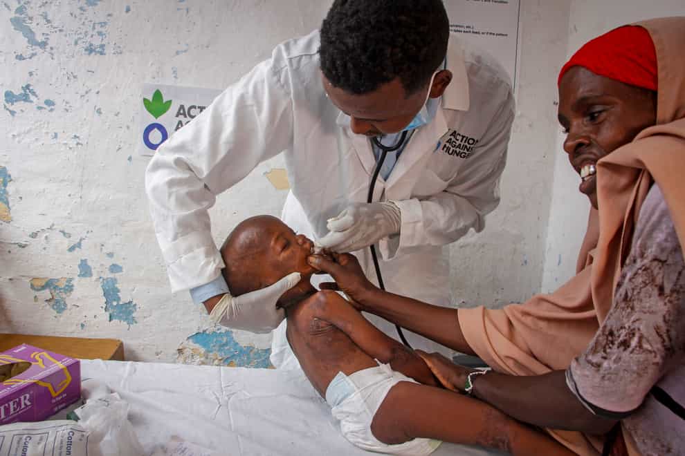 Doctor Mustaf Yusuf treats Ali Osman, three, who is showing symptoms of Kwashiorkor, a severe protein malnutrition causing swelling and skin lesions, as his mother Owliyo Hassan Salaad, 40, holds him at a malnutrition stabilisation centre run by Action against Hunger, in Mogadishu (AP)