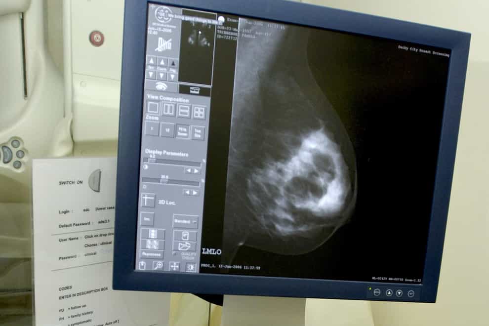 Breast cancer spreads at night, new research suggests (Rui Vieira/PA)