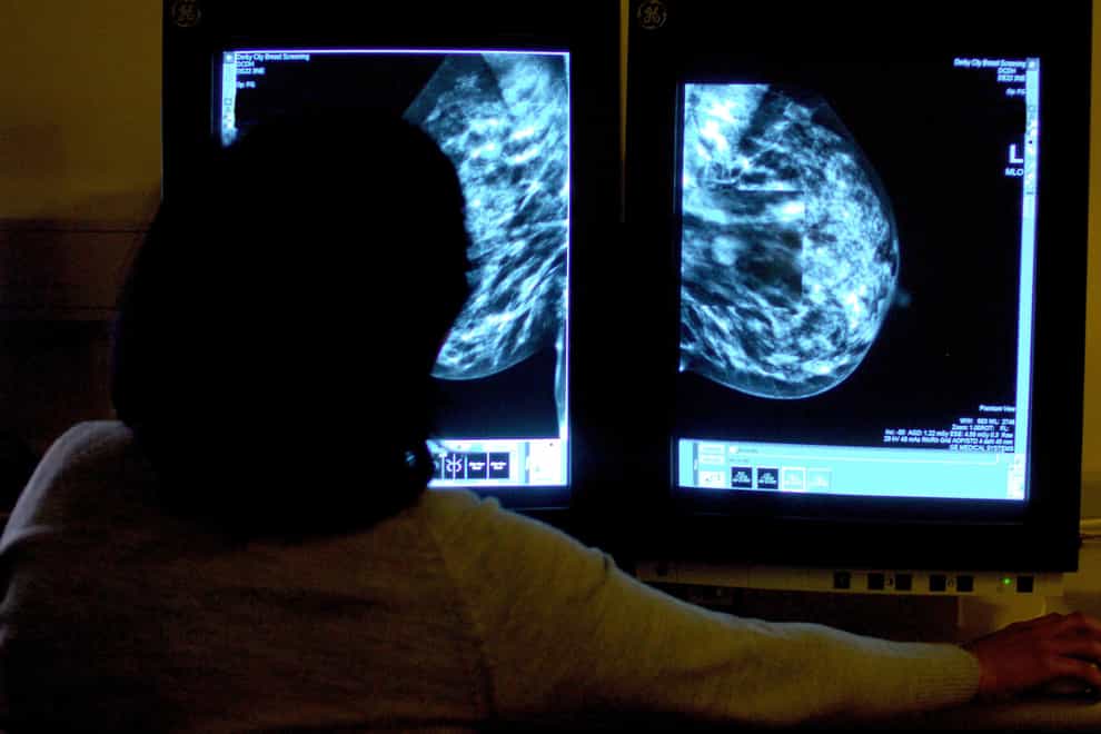 Two new breast cancer drugs approved for use in England (PA)