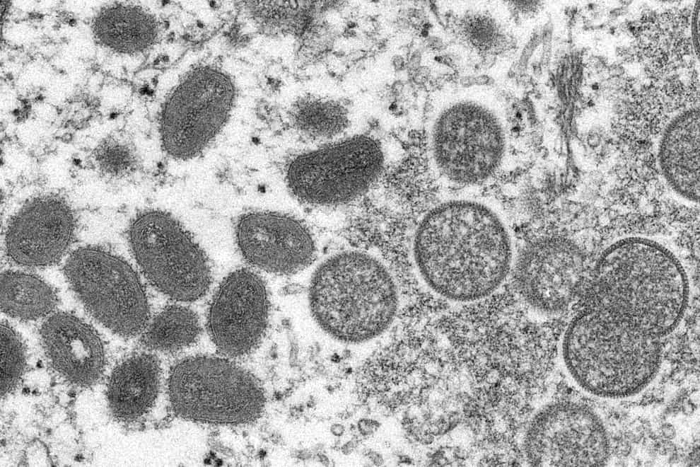 The European Medicines Agency has said the smallpox vaccine made by Bavarian Nordic should also be authorised against monkeypox (Cynthia S Goldsmith, Russell Regner/CDC via AP/PA)