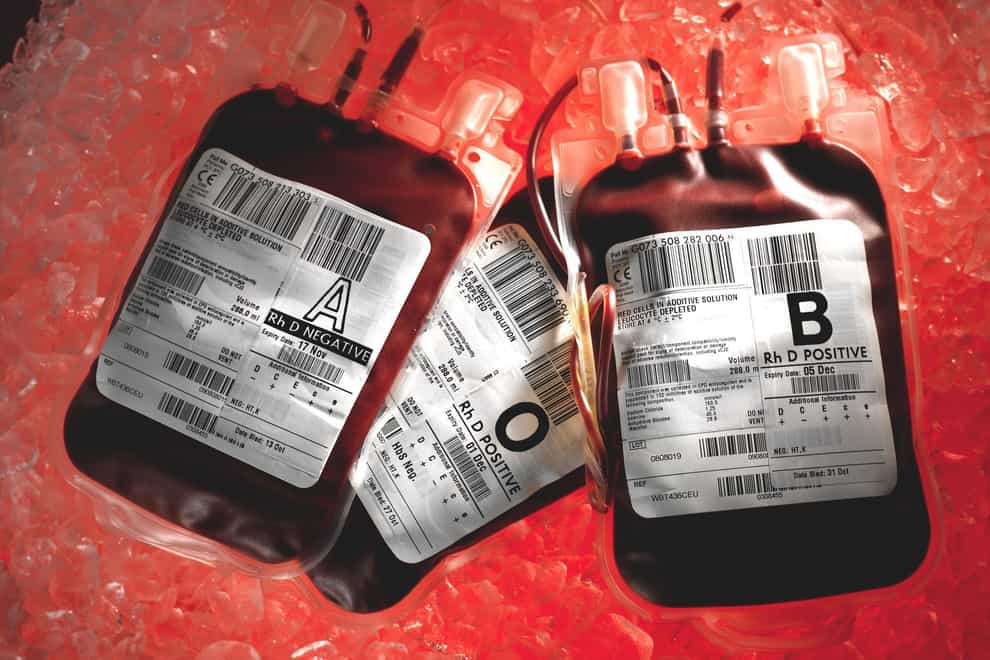 Undated NHS Blood and Transplant handout photo of blood bags. Thousands of patients are to be recalled for tests to see if they have been infected with blood-borne viruses which could include HIV. The recall has been sparked amid concerns over a dentist who treated patients in Nottingham over a 32-year period.