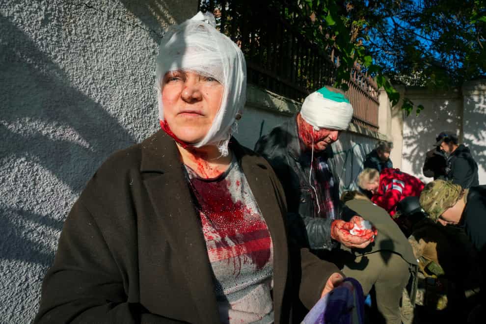 People receive medical treatment at the scene of Russian shelling in Kyiv (Efrem Lukatsky/AP)