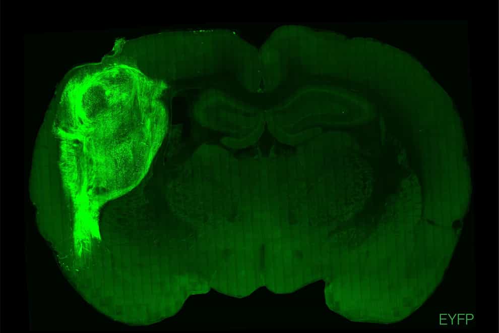 Scientists have successfully transplanted human brain tissue into the brains of newborn rats, where human and rodent nerve cells connected, developed and matured to form working circuits (Stanford University/PA)