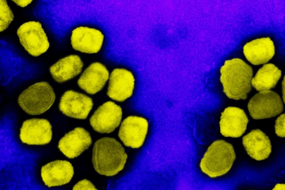 A colorized transmission electron micrograph of monkeypox virus particles (yellow) cultivated and purified from cell culture (Image captured at the NIAID)