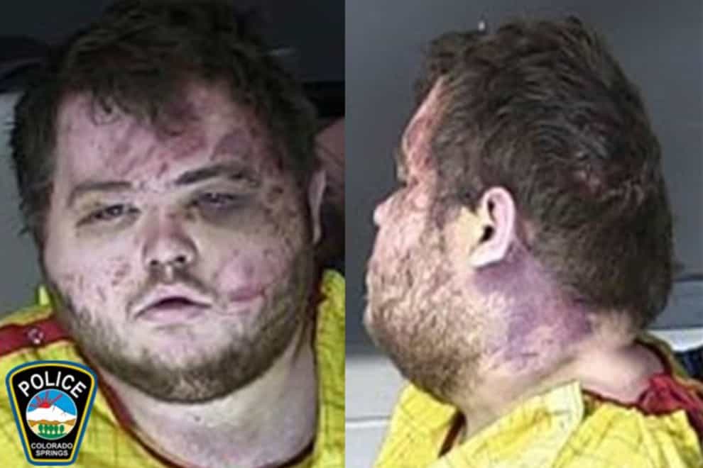 The alleged shooter facing possible hate crime charges in the fatal shooting of five people at a Colorado Springs gay nightclub was ordered to be held without bail (Colorado Springs Police Department/AP)