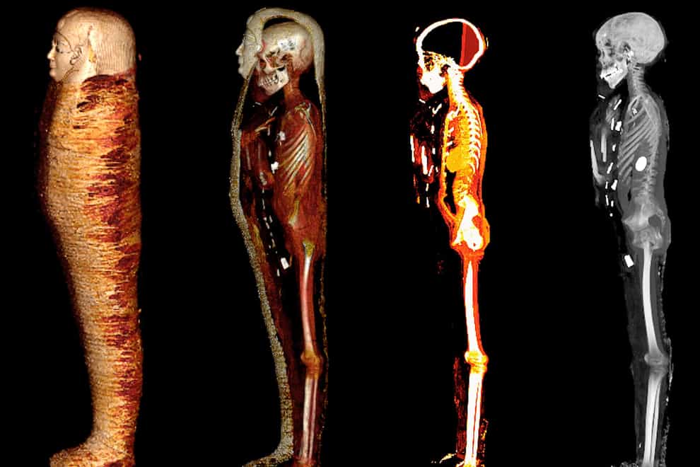 Four stages of a mummy being ‘digitally unwrapped’ by scientists (SN Saleem/SA Seddik/M el-Halwagy/PA)