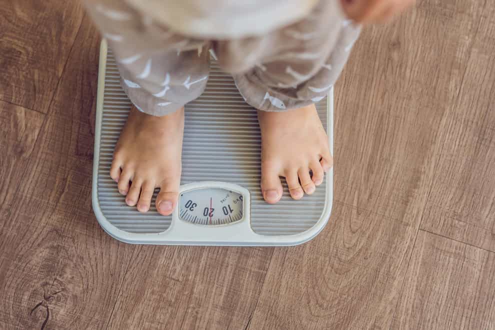 Diets can be the start of eating disorders (Alamy/PA)