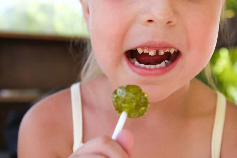 A study has shown almost a third of five-year-olds are suffering from tooth decay (Alamy/PA)