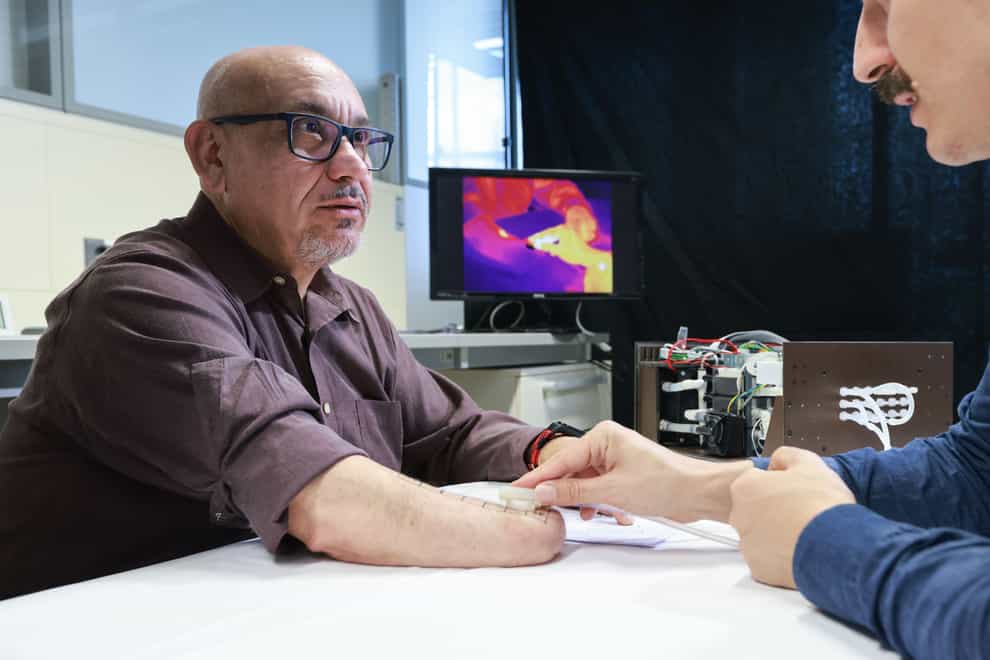 A patch of skin on amputee Fabrizio Fidati’s residual arm in contact with the device (Alain Herzog/EPFL/PA)