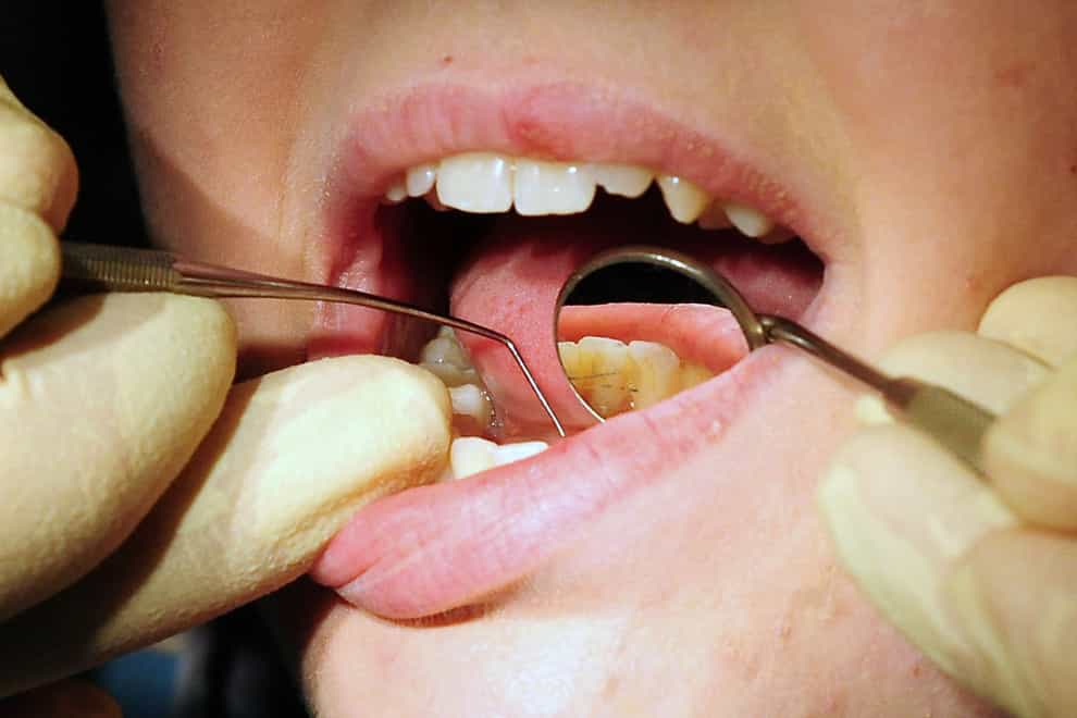 The Health and Social Care Committee’s report highlights instances of DIY dentistry (Rui Vieira/PA)